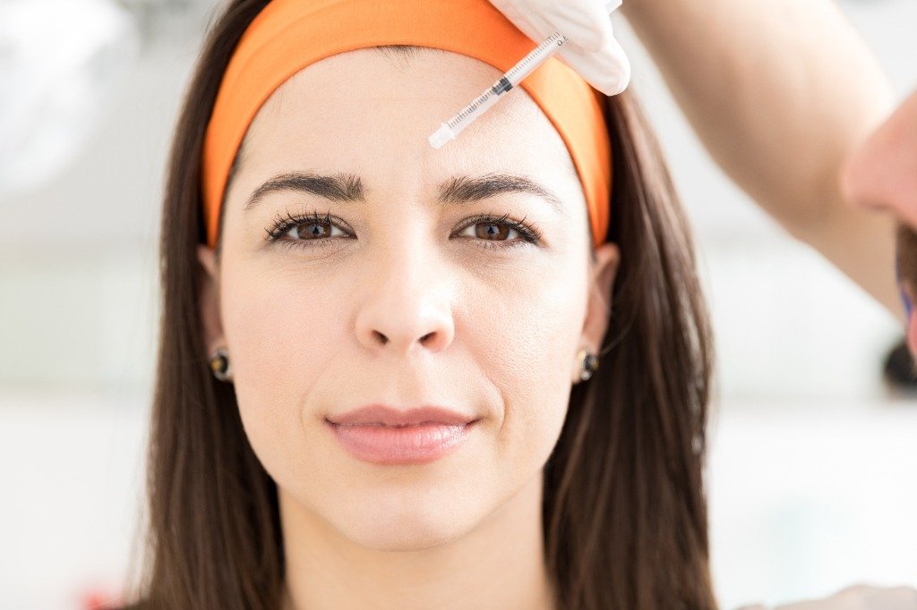 Resultado Botox